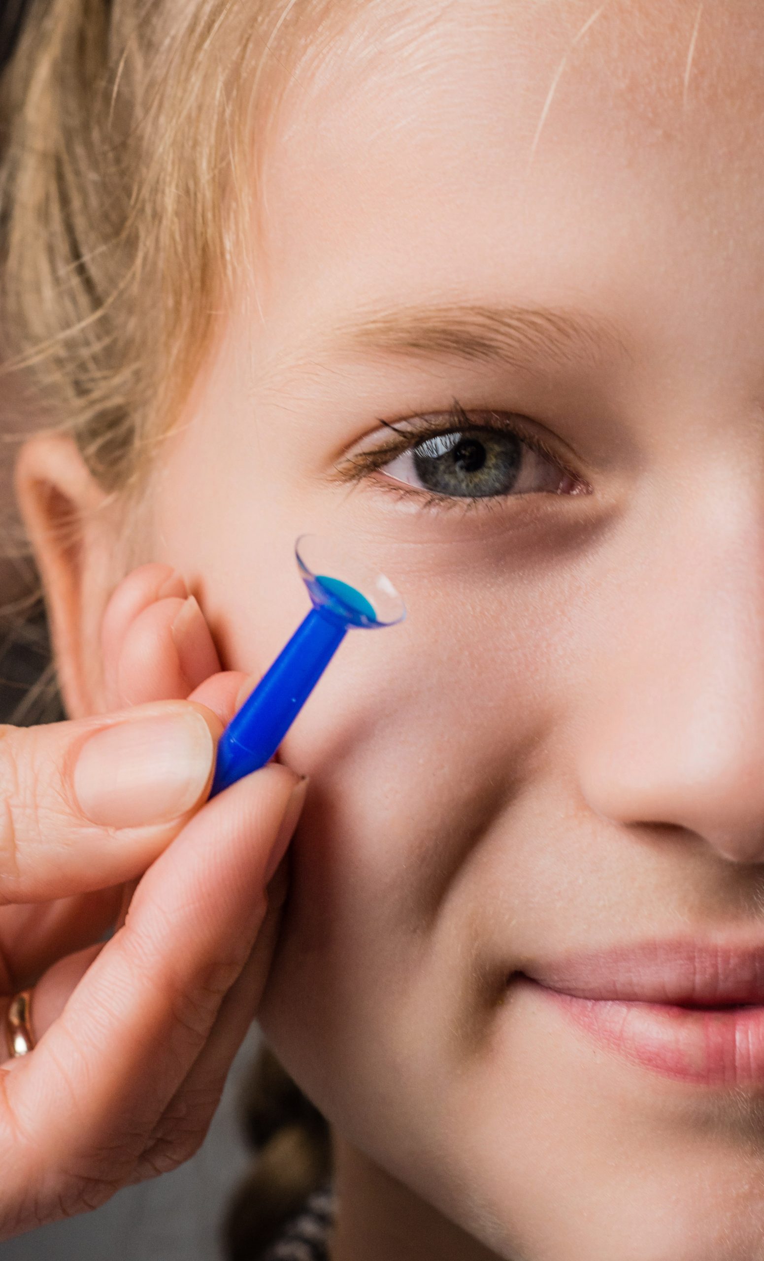 ПОДБОР НОЧНЫХ ЛИНЗ